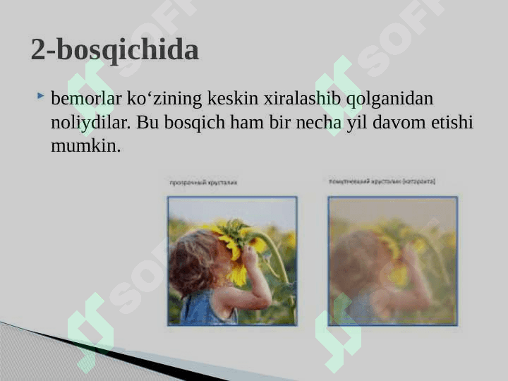 KEKSA VA QARIYALAR KO’Z , QULOQ A’ZOLARI KASALLIKLARI KECHISHINING O’ZIGA XOS XUSUSIYATLARI 7