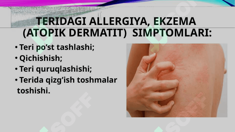 ALLERGIYA 7