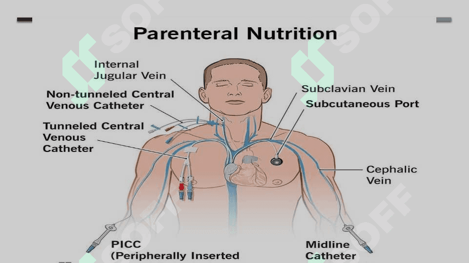 Parenteral ovqatlantirish va uning klinik ahamiyati 7