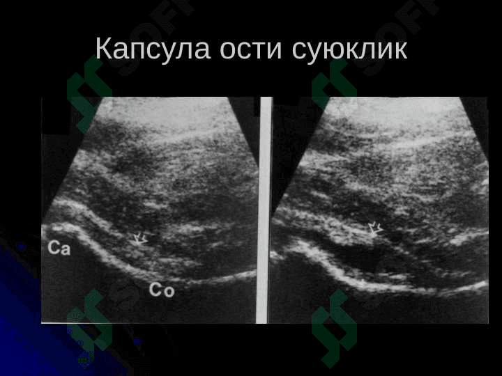 Таянч-харакат тизими касалликларининг нур ташхиси 6