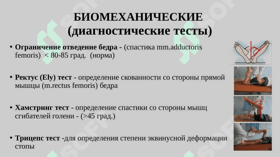 Ортопедические аспекты детского церебрального паралича 2
