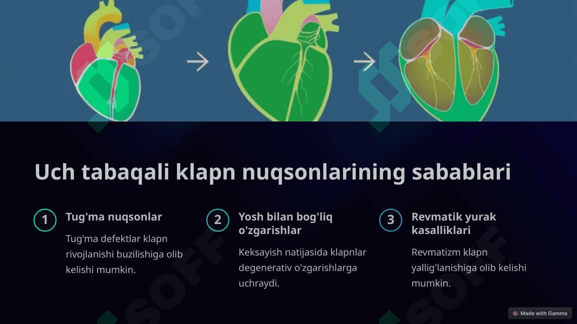 Uch tabaqali klapn nuqsonlari 3