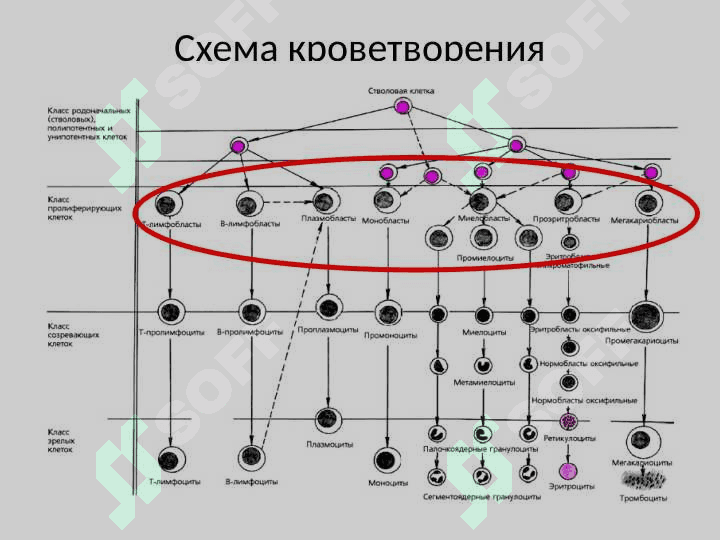 Гемобластозы 4