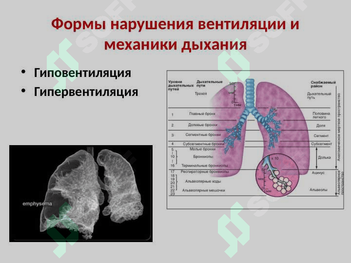 Патофизиология дыхания 7