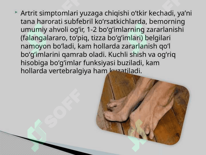 REAKTIV ARTRITLAR 8