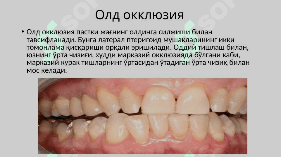 Артикуляция,окклюзия.Окклюзия турлари: марказий,олдинги,латерал.Юқори ва пастки жағ тишларининг ўзаро таъсири.Тишларни сиқиш белгилари.Тишлаш турлари 6