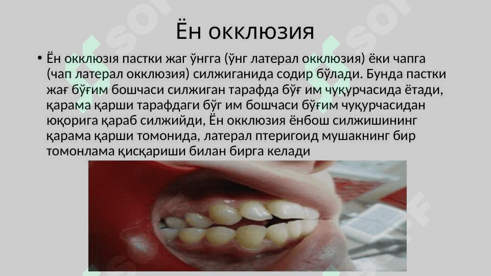 Артикуляция,окклюзия.Окклюзия турлари: марказий,олдинги,латерал.Юқори ва пастки жағ тишларининг ўзаро таъсири.Тишларни сиқиш белгилари.Тишлаш турлари 7