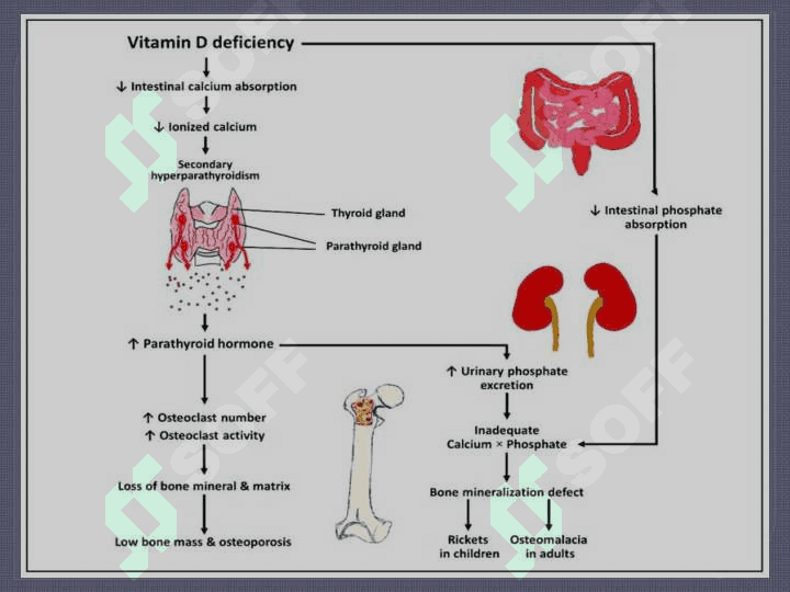 Gipovitaminoz va gipervitaminoz holatlarda modda almashinuvining buzilishi 3