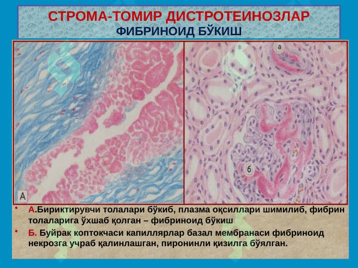 Stroma-tomir distrofiyalar 8