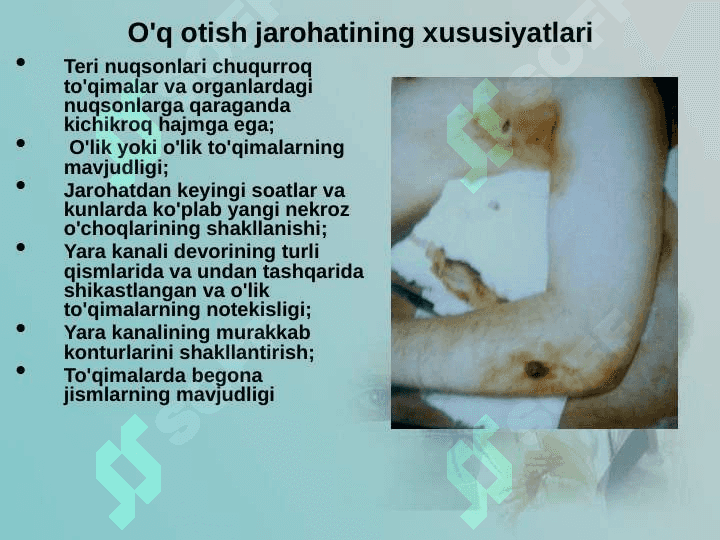 Zamonaviy o'q-dorilarning halokatli ta'sirining xususiyatlari. O'q otish jarohati patogenezi 8