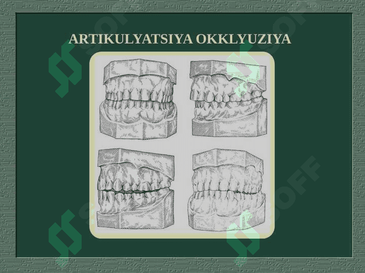 Artikulyatsiya va Okklyuziya, ularning turlari 4