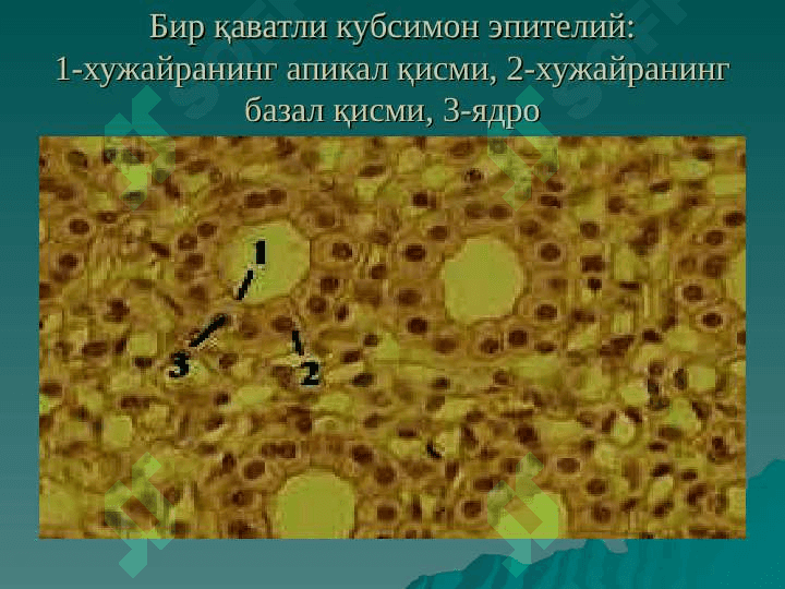 ЭПИТЕЛИЙ ТЎҚИМАСИ 6