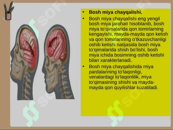 Bosh miyaning infeksion kasaliklari 5