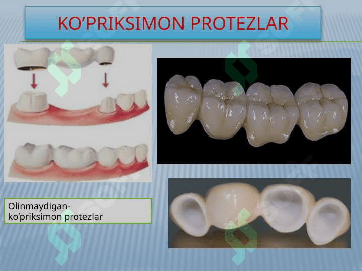 Sirkoniydioksid stomatologik keramika farfor 8