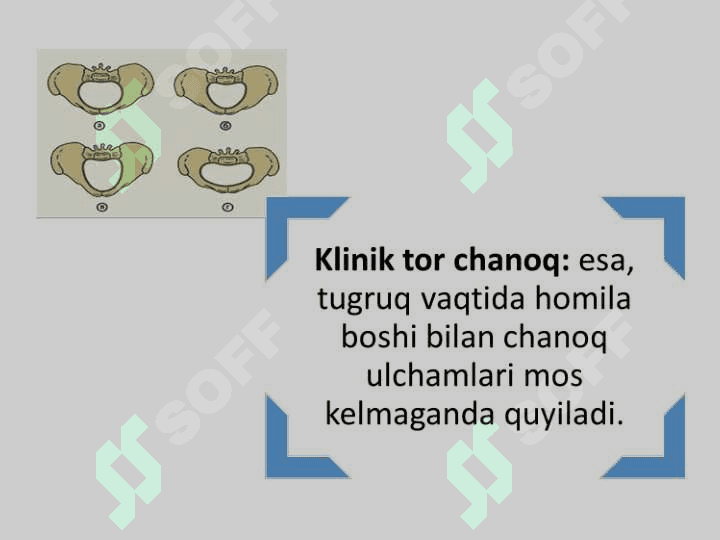 Zamonaviy akusherlikda tor chanoq. 7