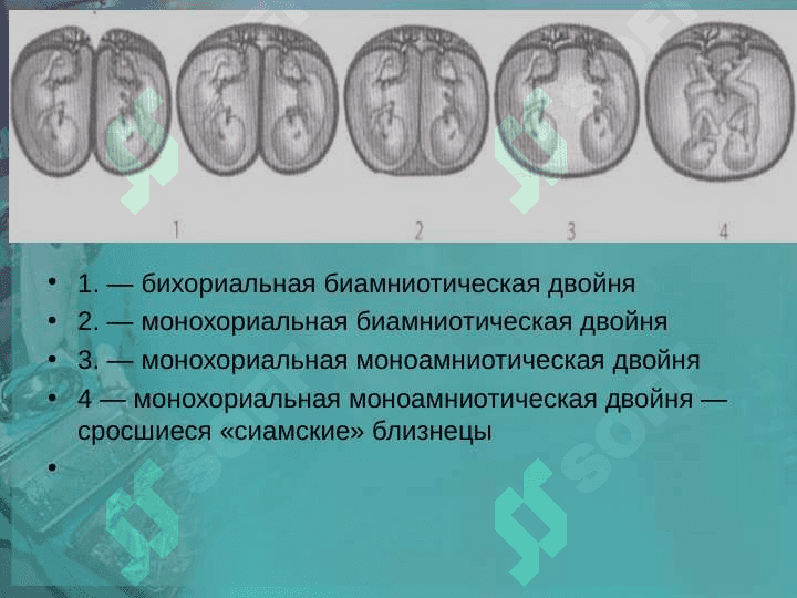 МНОГОПЛОДНАЯ БЕРЕМЕННОСТЬ.   АНТЕНАТАЛЬНЫЙ УХОД И ВЕДЕНИЕ РОДОВ У БЕРЕМЕННЫХ С ДВОЙНЕЙ И ТРОЙНЕЙ. 6