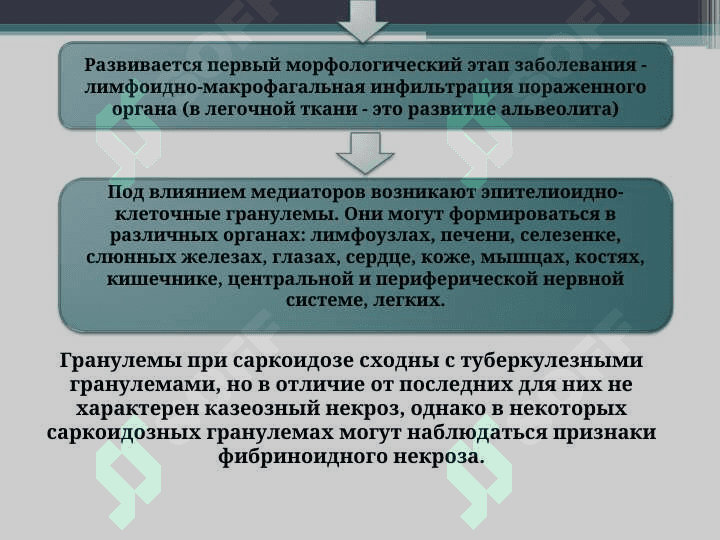 Саркоидоз легких 6