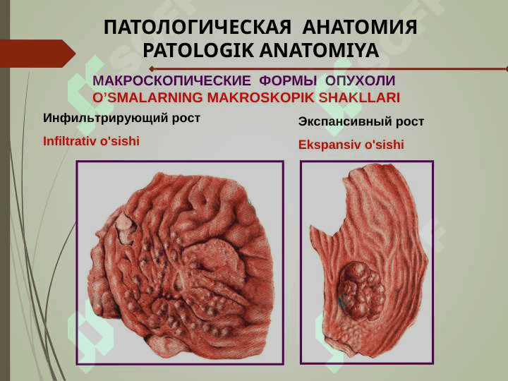 ONKOLOGIYA ASOSLARI. ОСНОВЫ ОНКОЛОГИИ 7