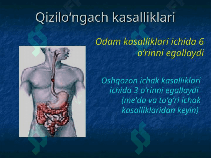 QIZILO`NGACH KASALLIKLARI. 2