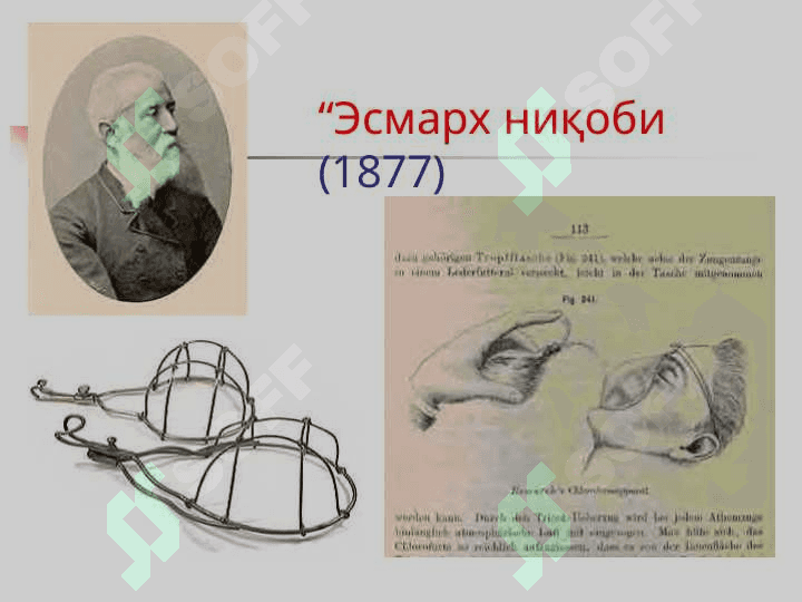 Анестезиология ва реаниматология. Замонавий оғриқсизлантиришни турлари, усуллари ва таснифи. Наркоз 8