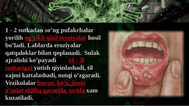 Oqsim kasalligi 4