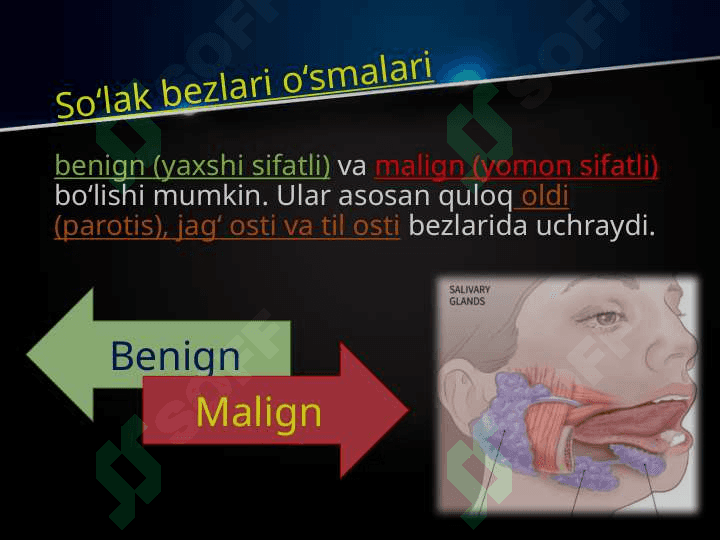 So’lаk bеzlаri o’smаlаri. Mоnоmоrf аdеnоmа, pоlimоrf аdеnоmа, mukоepidеrmоid o’smа. Klinikаsi, tаshxislаsh vа dаvоlаsh. Аdеnоkаrsinоmа. Tаshxislаsh vа dаvоlаsh prinsiplаri. 2
