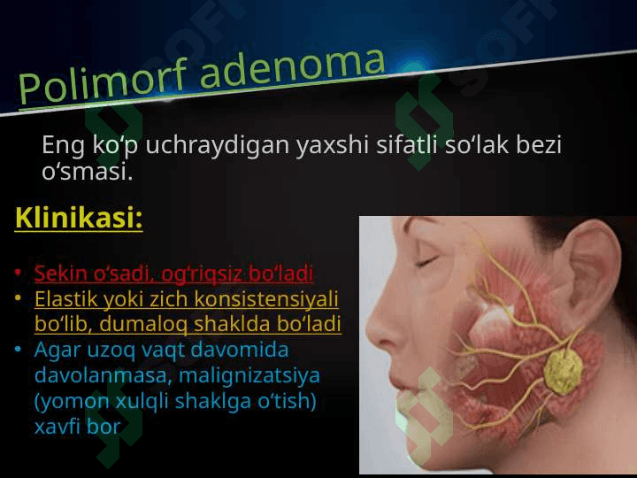 So’lаk bеzlаri o’smаlаri. Mоnоmоrf аdеnоmа, pоlimоrf аdеnоmа, mukоepidеrmоid o’smа. Klinikаsi, tаshxislаsh vа dаvоlаsh. Аdеnоkаrsinоmа. Tаshxislаsh vа dаvоlаsh prinsiplаri. 5