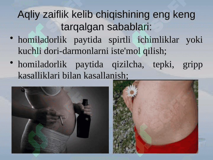 Aqliy rivojlanishida nuqsoni bo‘lgan bolalar 8