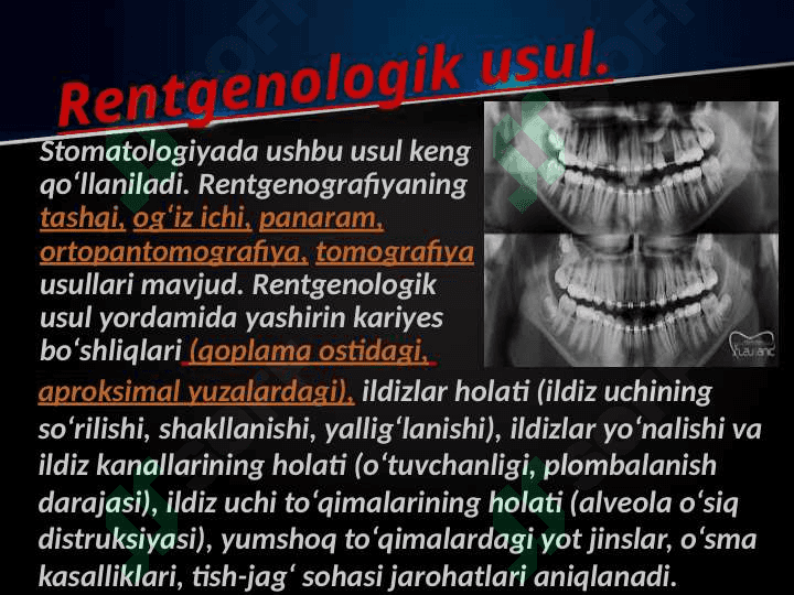 Stomatologik bemorni qo'shimcha tekshirish usullari 3