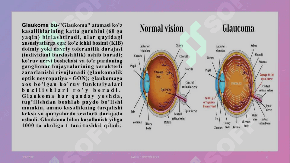 Glaukoma 2