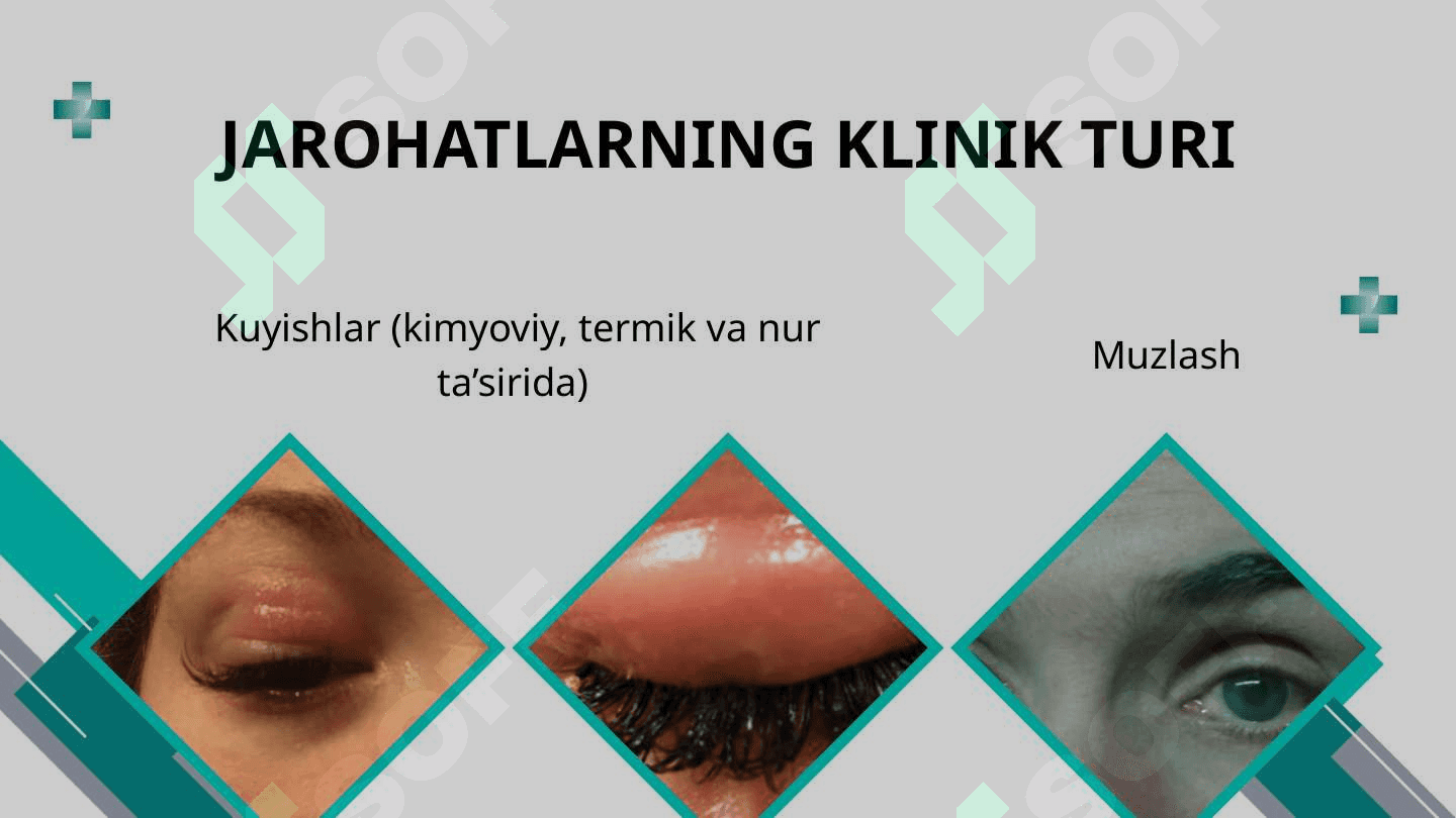 Ko'ruv a'zosi jarohatlari 7