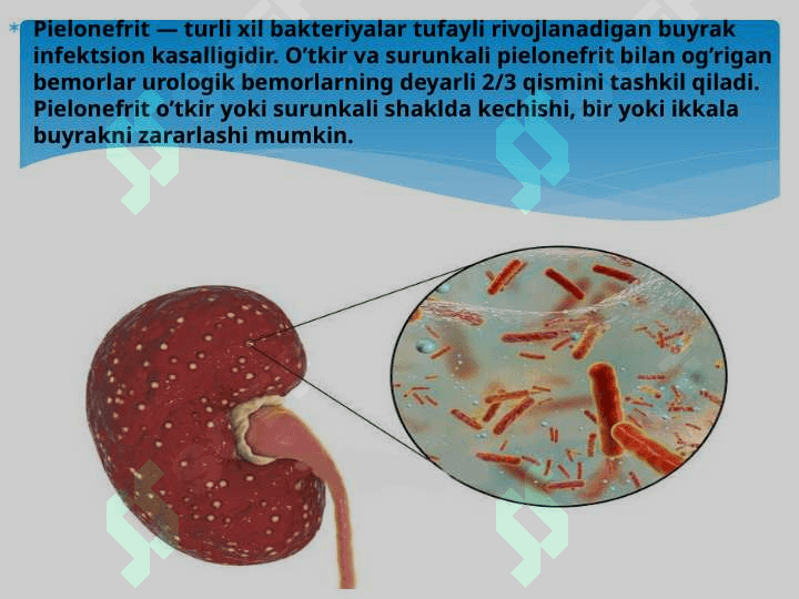 o'tkir va surunkali piyelonefrit 2