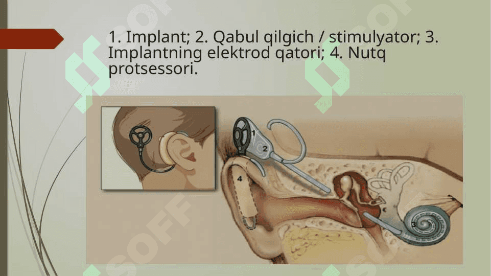 Koxlear implantatsiya: texnologiya, tibbiyot, surdopedagogika va logopediyaning rivojlanishidagi inovatsiya 4