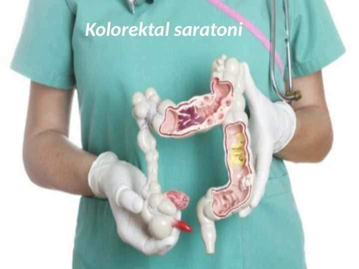 Kolorektal saratoni 1