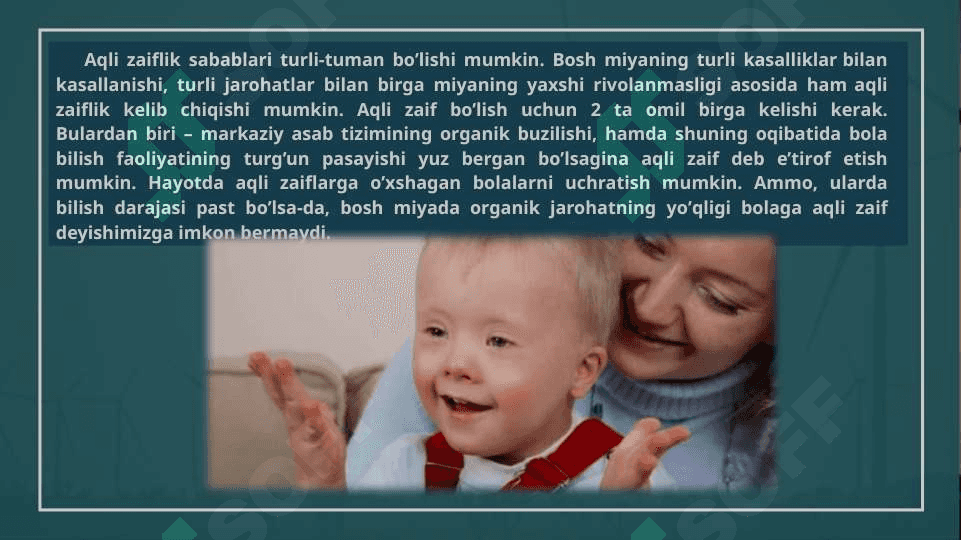 aqli zaif bolalarning aqliy faoliyati 3