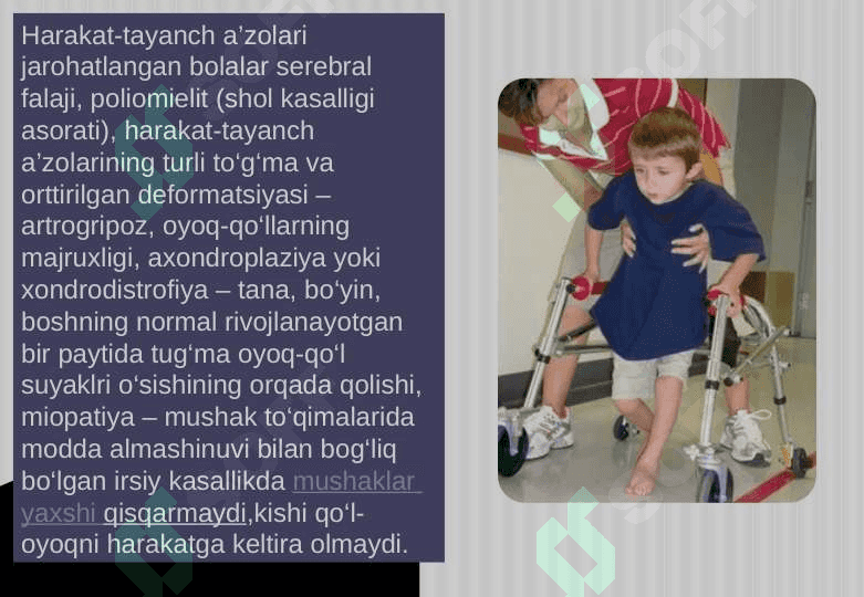 Harakat tayanch a’zolari jarohatlangan bolalar 2
