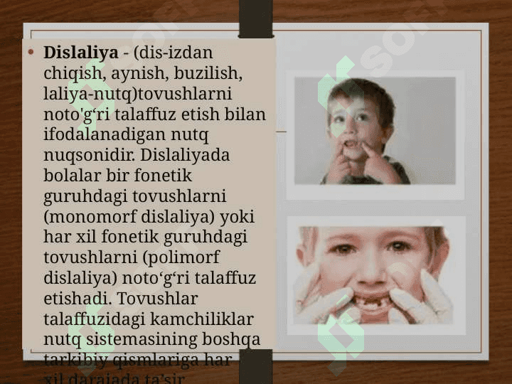 NUTQIDA NUQSONI BO'LGAN BOLALAR 2