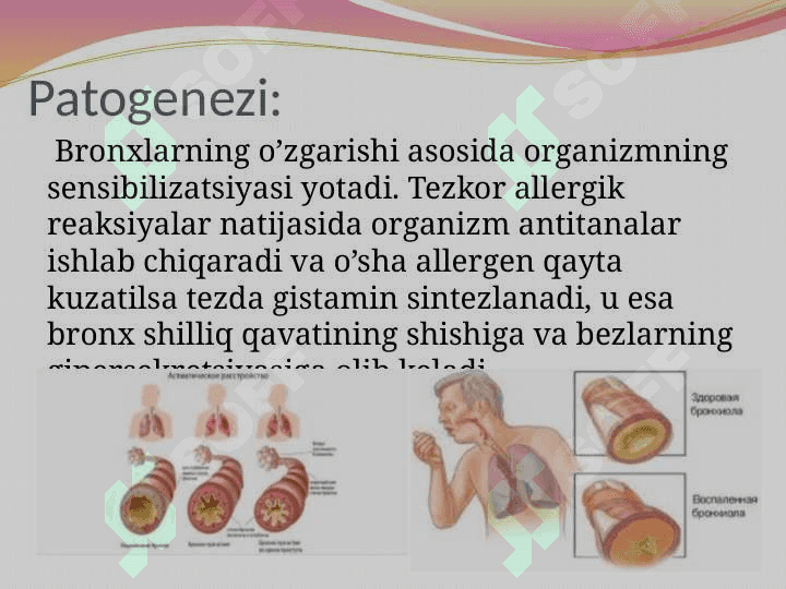 Astma . Bronxial astma 7