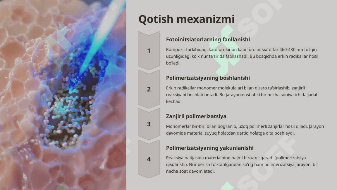 Nur yordamida qotuvchi kompozit plombalar. 5