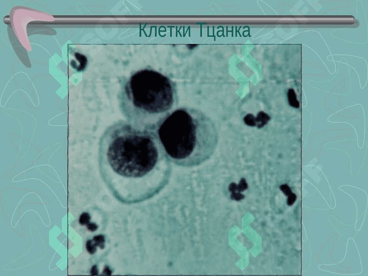 Пемфигоид (этиология, патогенез, клинические проявления, диагностика) 8