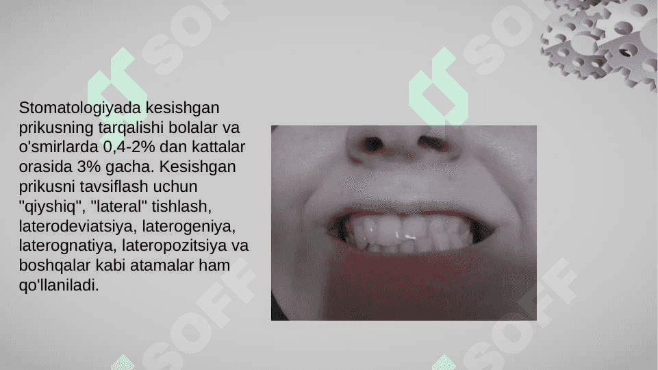 Kesishgan prikus 4