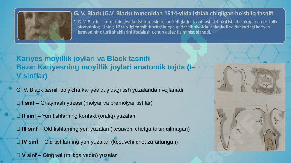 Blek bo‘yicha III- IV sinfli karies kovaklarini restavratsiya qilishning klinik tamoyillari. 7