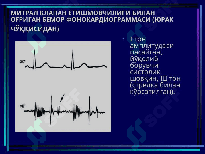 ОРТИРИЛГАН ЮРАК НУҚСОНЛАРИ 8