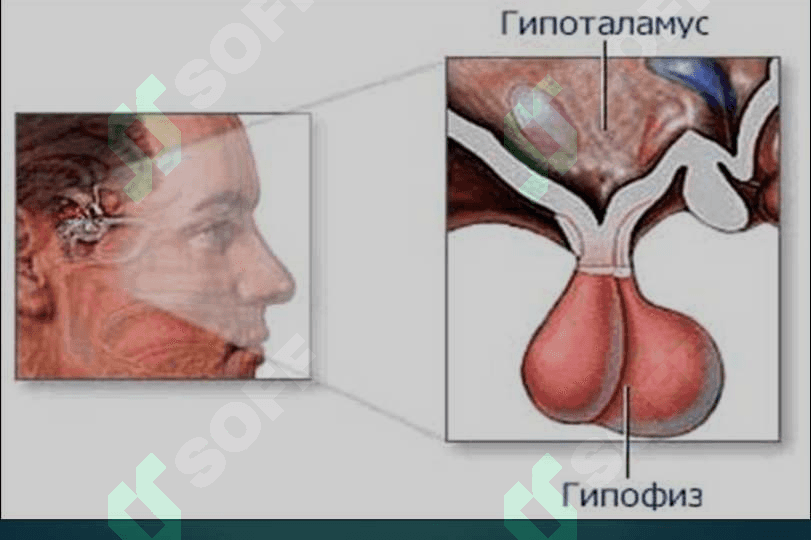 акромегалия, гипофизар нанизм, кандсиз диабет 4
