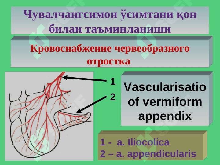 Острый аппендицит 5