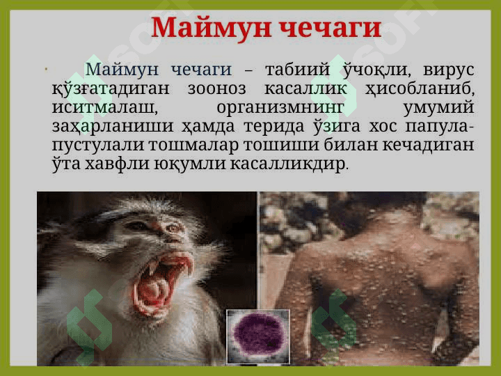 МАЙМУН ЧЕЧАГИ   ЭПИДЕМИОЛОГИЯ ВА ПРОФИЛАКТИКАСИ 2