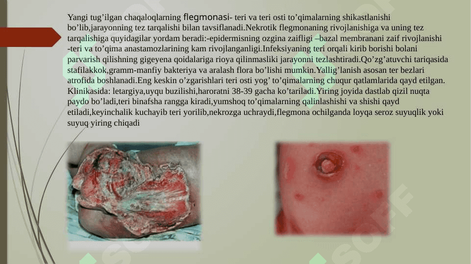 Chaqaloqlarning yiringli-yallig’lanish kasalliklari 4