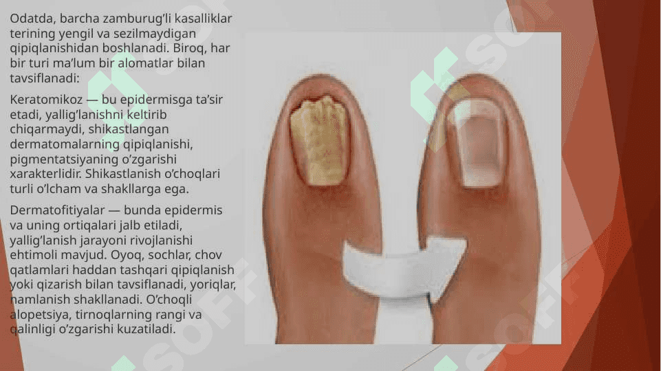 Chuqur mikozlar, mikozlar 4