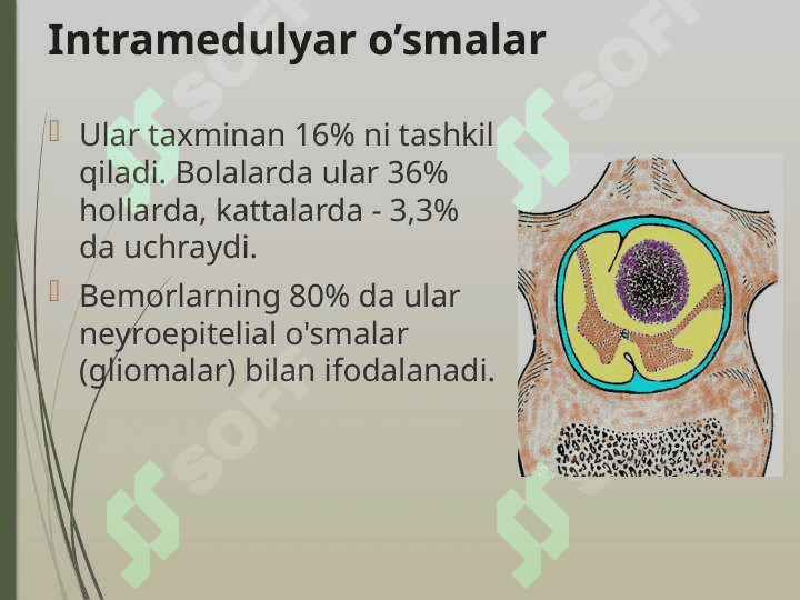 Orqa miya o’smalari 5