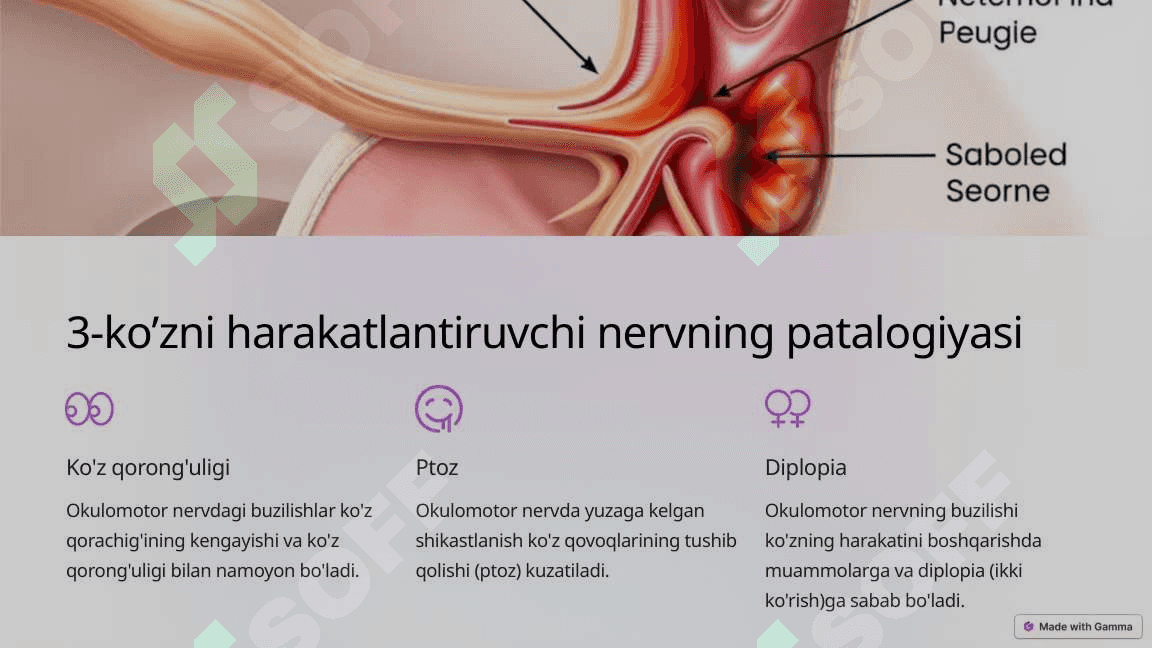 12 juft bosh miya nervlari Crainal Nervlarning Patalogiyasi 6